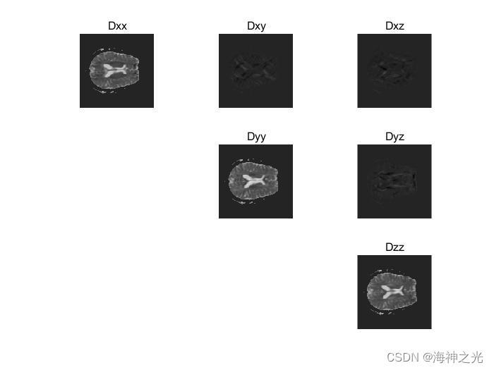 【图像分割】基于matlab扩散张量成像（DTI）脑白质纤维束成像【含Matlab源码 2174期】_神经网络