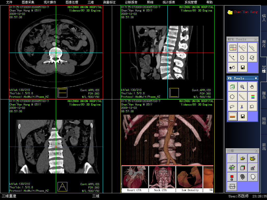 医学影像临床信息系统源码（PACS）_模拟视频_02