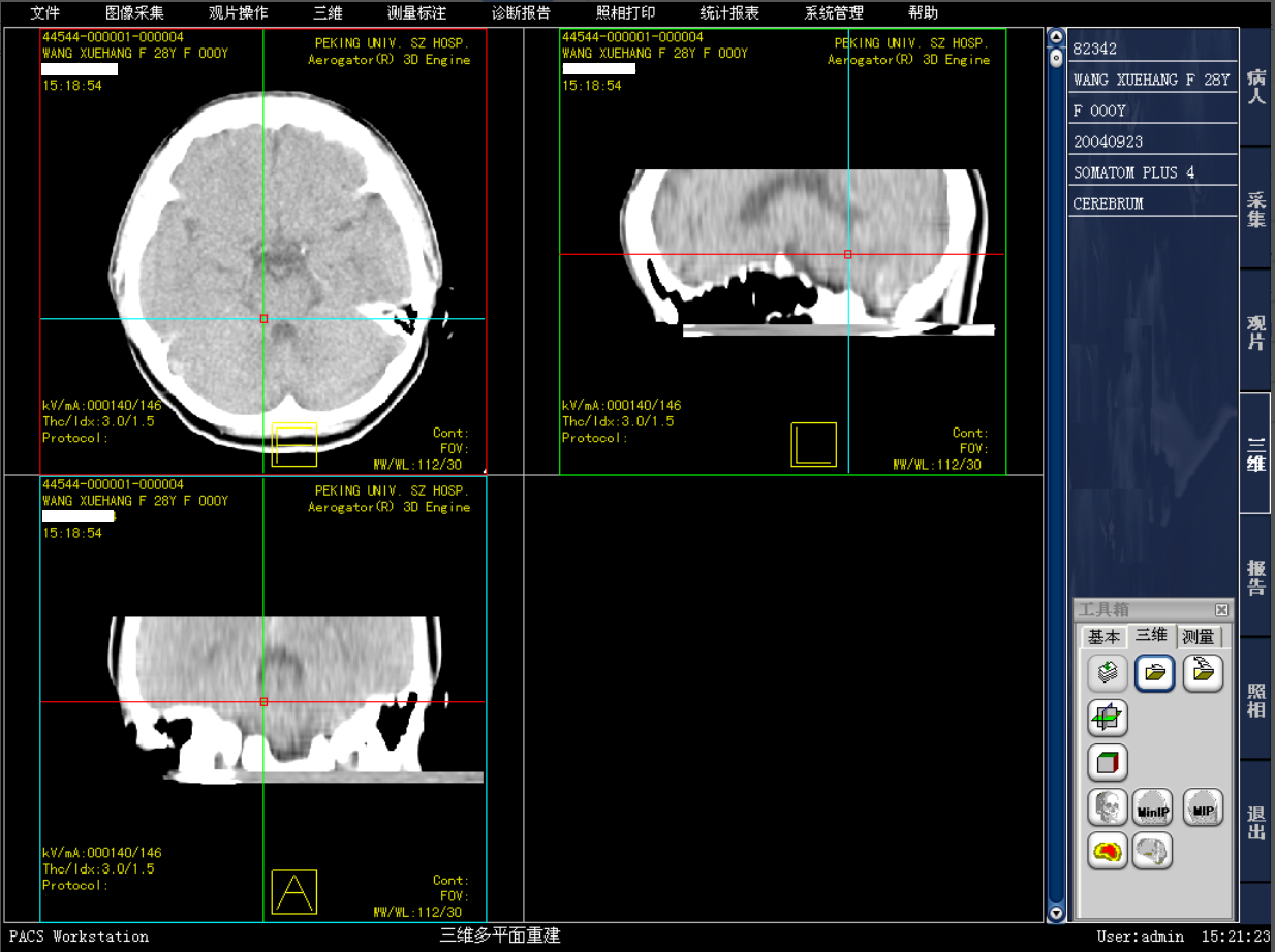医院影像图像科室工作站PACS系统 DICOM  三维图像后处理与重建_输入法_03