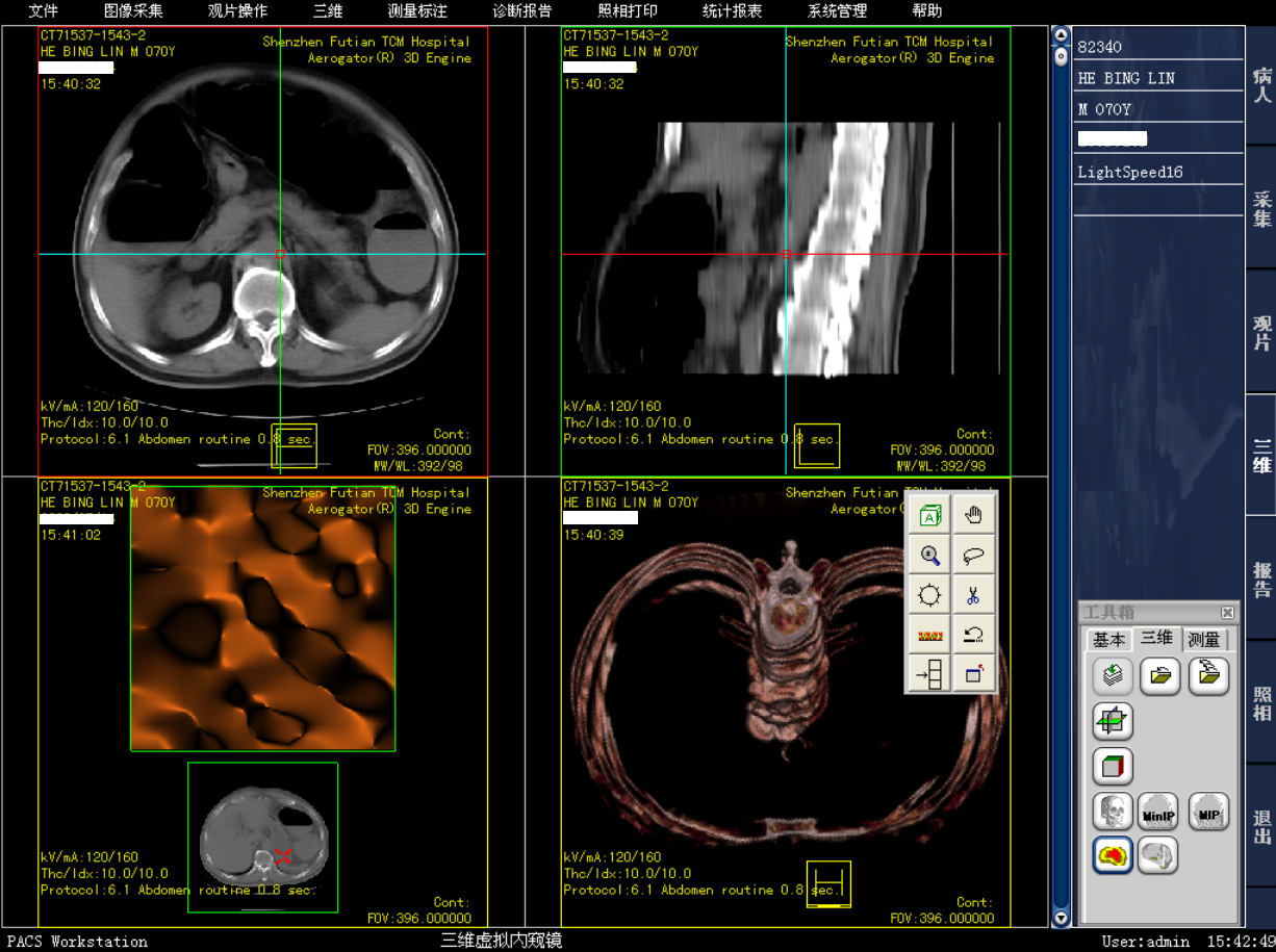 医院影像图像科室工作站PACS系统 DICOM  三维图像后处理与重建_系统安装_02