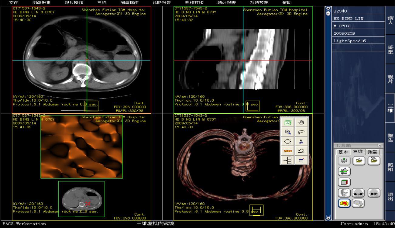 ​医院医学影像PACS系统源码，三维多平面重建、三维容积重建、心脏动脉钙化分析_数据_03