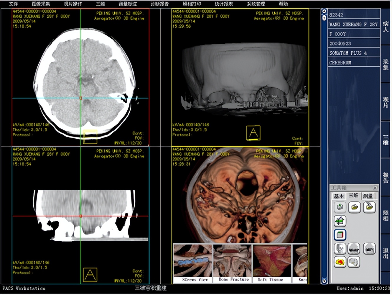医学影像归档与通讯系统（PACS）系统源码 PACS三维图像处理_显示模式_06
