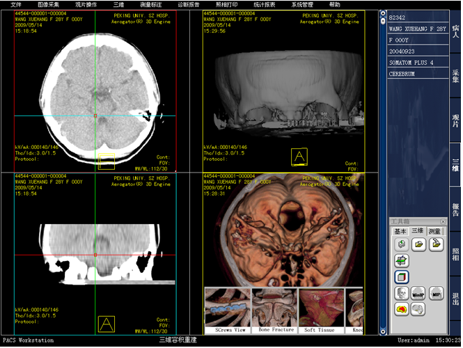 PACS医学影像处理系统源码-虚拟内窥镜 三维重建技术 _医学影像_04