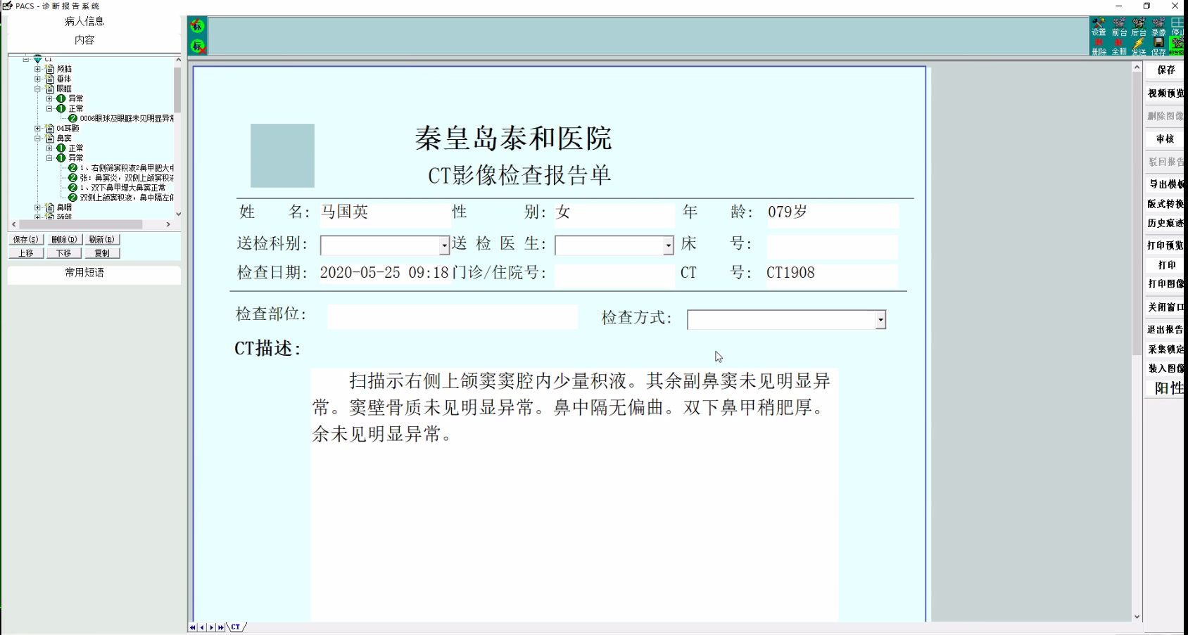 PACS医学影像处理系统源码-虚拟内窥镜 三维重建技术 _数据交换_02