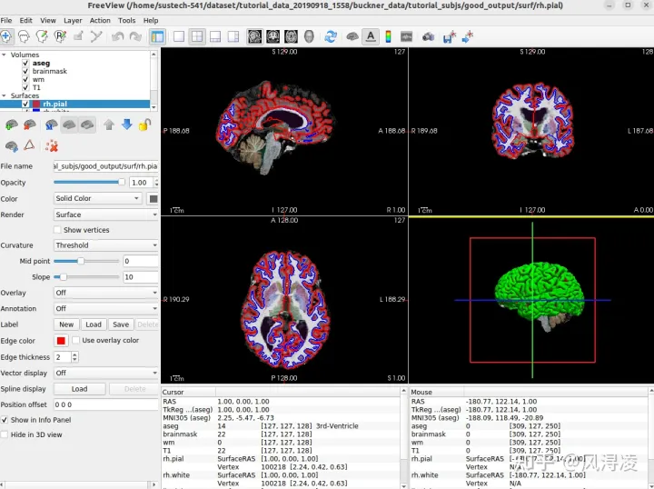 学习笔记431—freesurfer下载安装，常用术语和recon-all命令_bash_02