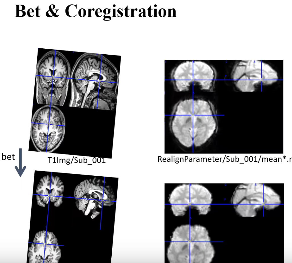 学习笔记430—fMRI数据处理_ico_05