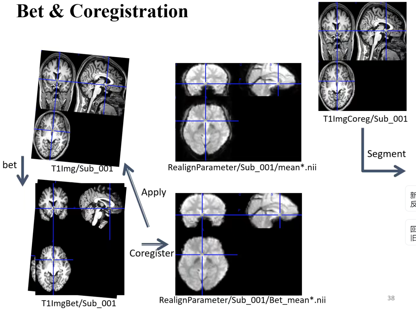 学习笔记430—fMRI数据处理_ico_06
