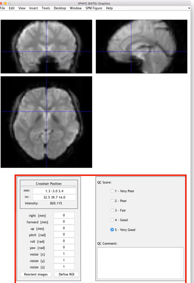学习笔记430—fMRI数据处理_预处理_04