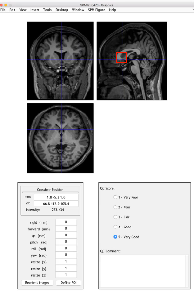 学习笔记430—fMRI数据处理_预处理_03